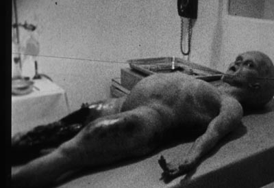 Alien Autopsy Photograph